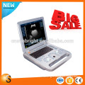 Full Digital B&W Portable Ultrasound Medical Machine For VET